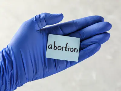 doctor's hand with a chit written with abortion